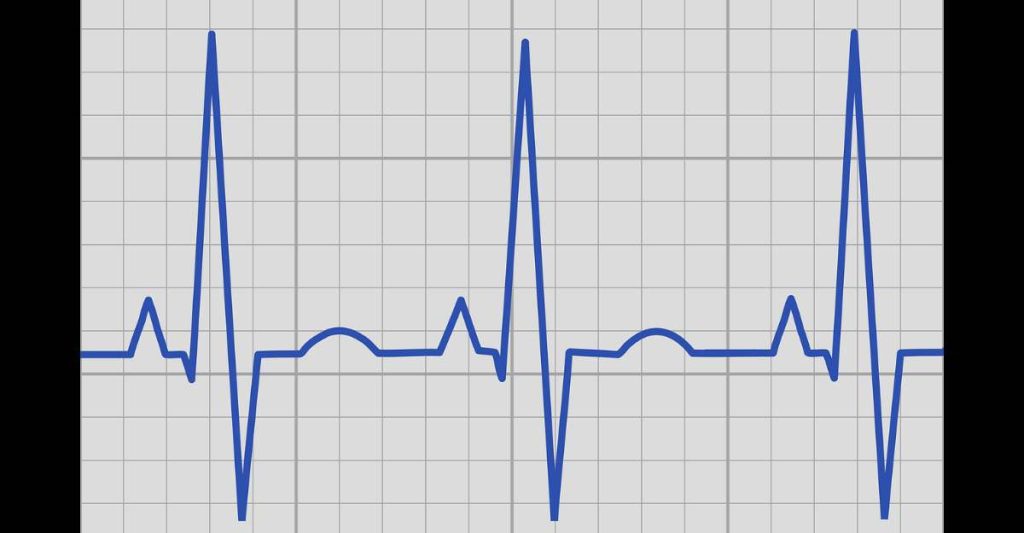 Electrocardiography