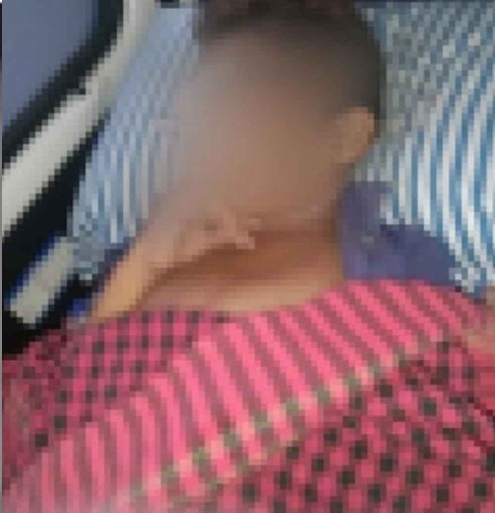 छत्तीसगढ़-बीजापुर में मृत छात्र के दिल की कैविटी में मिला पानी