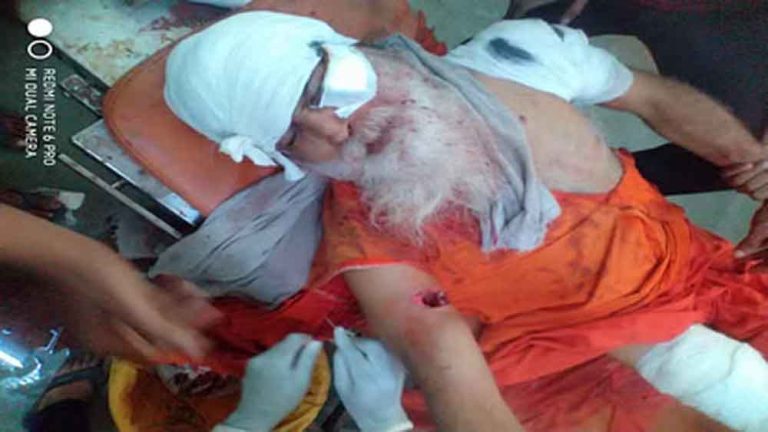 राजस्थान-सवाई माधोपुर में रणथंभौर के भालू ने दादूपंथी संत को किया लहूलुहान