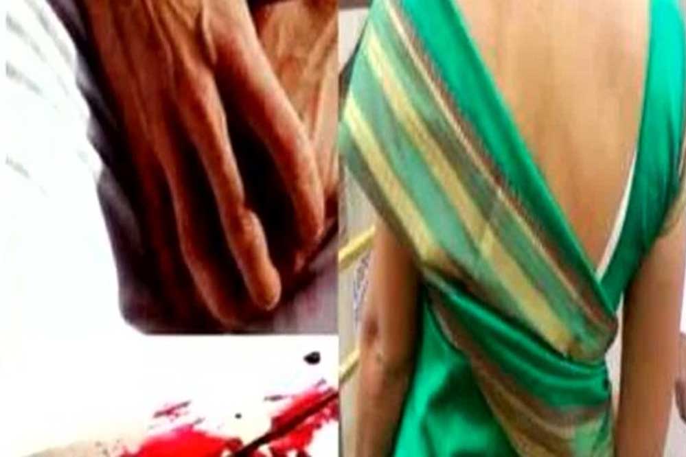 पत्नी को आया गुस्सा, काट डाला प्राइवेट पार्ट, पुलिस ने बताई पूरी वारदात 1 2A 76