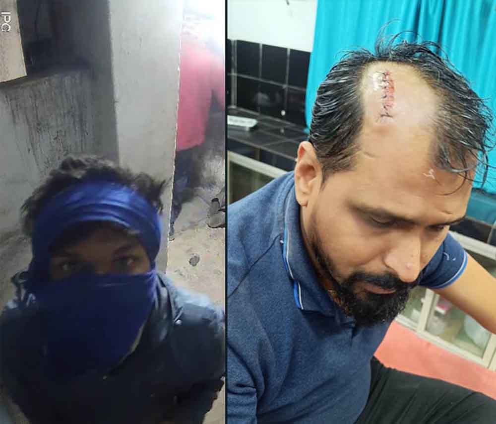 छत्तीसगढ़-कोरबा में पकड़ते समय चोरों के पथराव में दो युवकों को आई गंभीर चोट 1 Cg 09 2