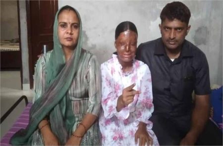 हिसार की बेटी ने चंडीगढ़ में ब्लाइंड स्कूल में 12वीं कक्षा में टॉप किया, एसिड अटैक में खोई थी आंखें